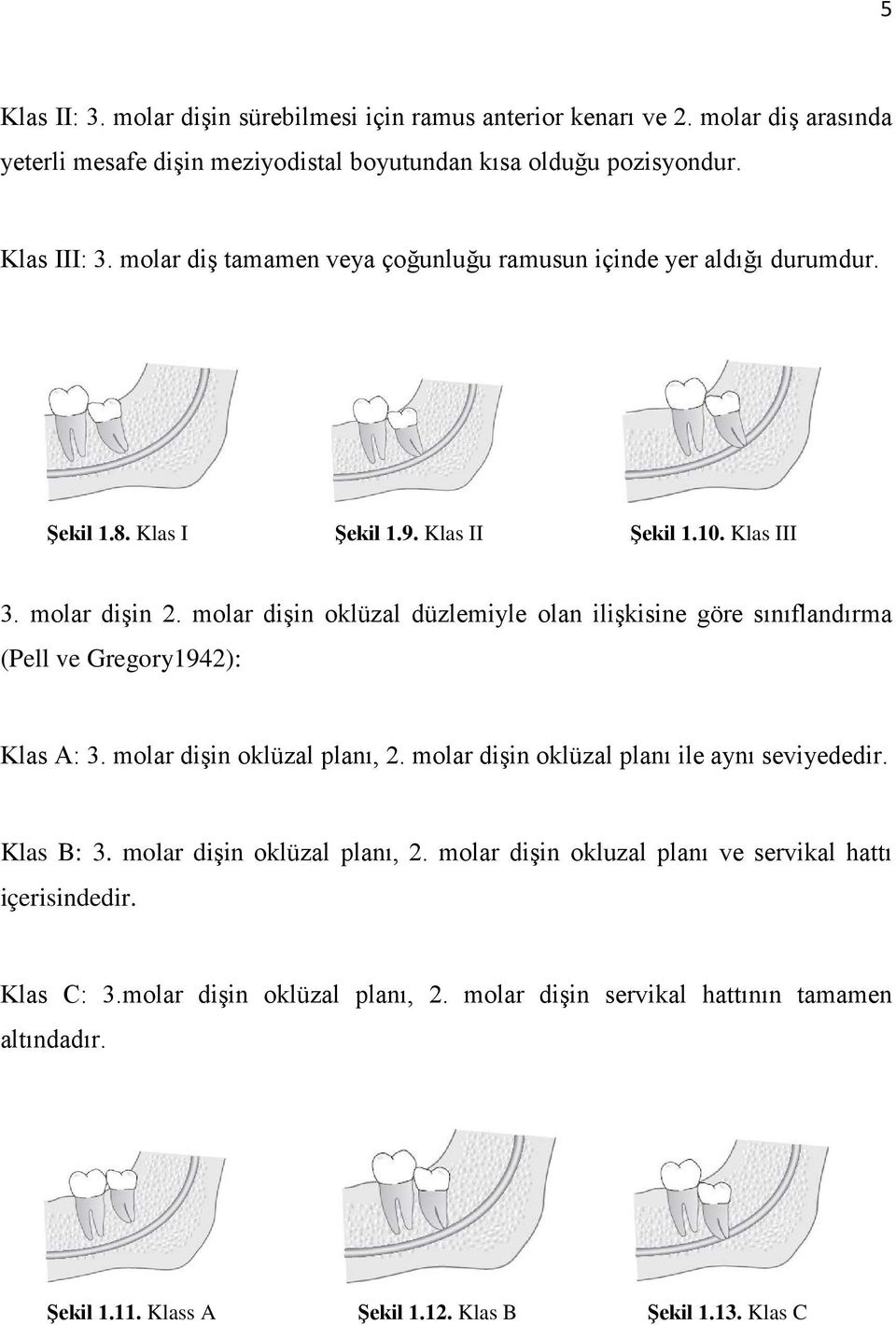 molar dişin oklüzal düzlemiyle olan ilişkisine göre sınıflandırma (Pell ve Gregory1942): Klas A: 3. molar dişin oklüzal planı, 2. molar dişin oklüzal planı ile aynı seviyededir.