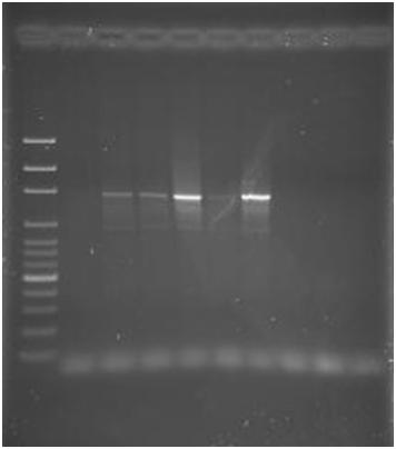 M 1 2 3 4 5 6 7 8 9 1462 bp Resim 8. Ehrlichia/lasma genus spesifik EC9 ileri ve EC12A geri yönlü primer çifti kullanılarak Akçaova Aralık 2006 ya ait DNA örneklerinin çoğaltılması.