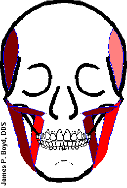 M.Pterygoideus eksternus + M.