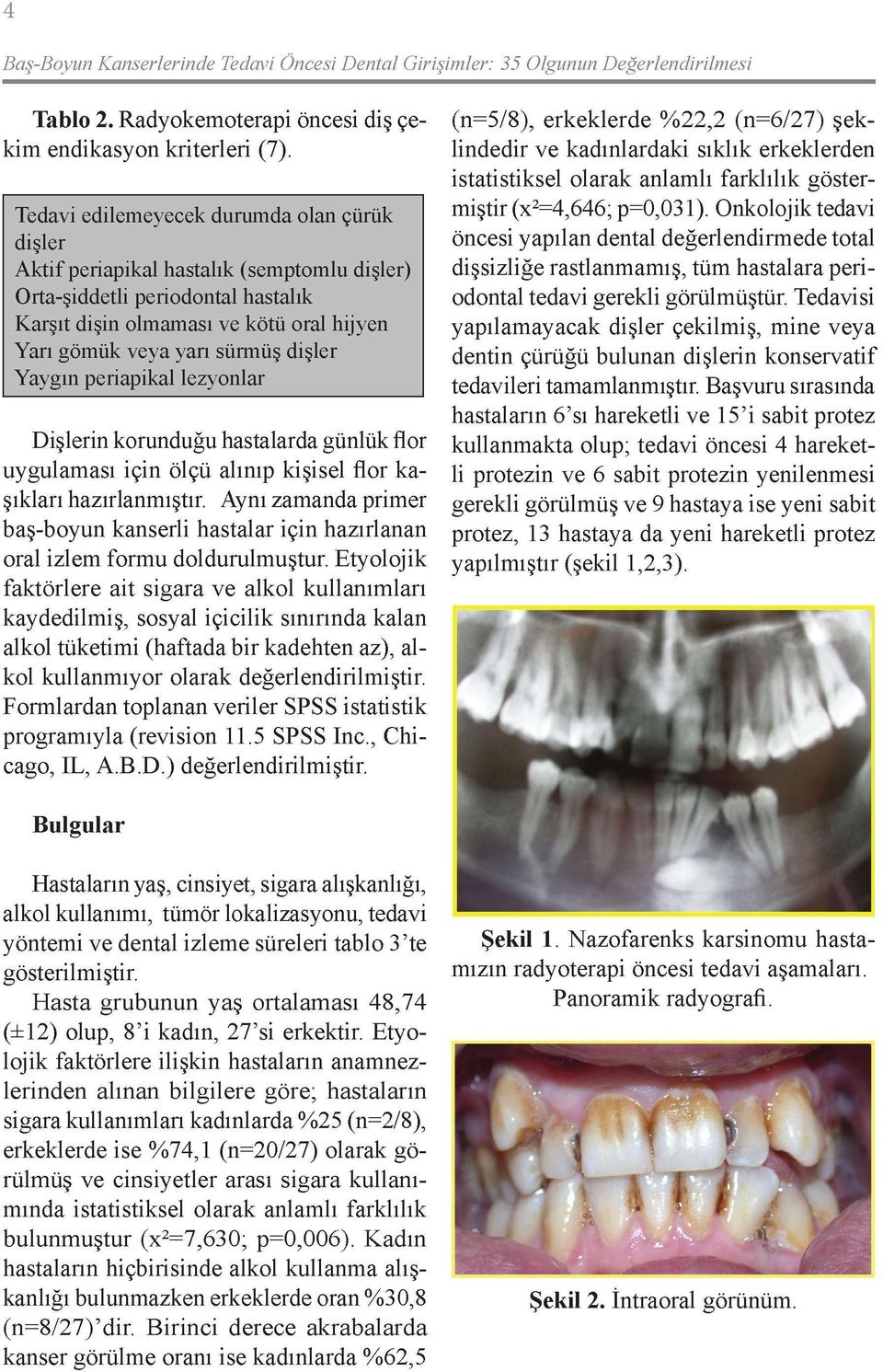 dişler Yaygın periapikal lezyonlar Dişlerin korunduğu hastalarda günlük flor uygulaması için ölçü alınıp kişisel flor kaşıkları hazırlanmıştır.