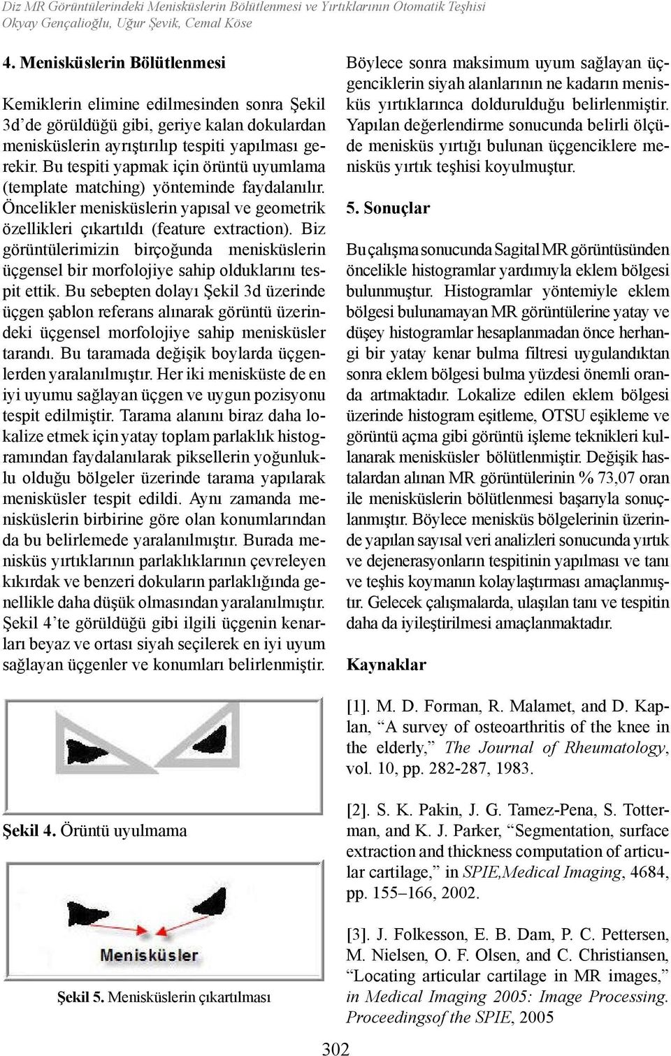 Bu tespiti yapmak için örüntü uyumlama (template matching) yönteminde faydalanılır. Öncelikler menisküslerin yapısal ve geometrik özellikleri çıkartıldı (feature extraction).