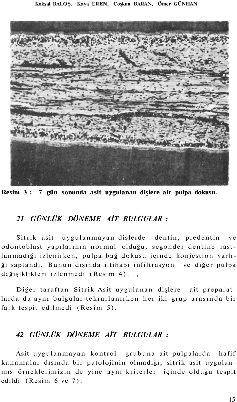 konjestion varlığı saptandı. Bunun dışında iltihabi infiltrasyon ve diğer pulpa değişiklikleri izlenmedi (Resim 4).