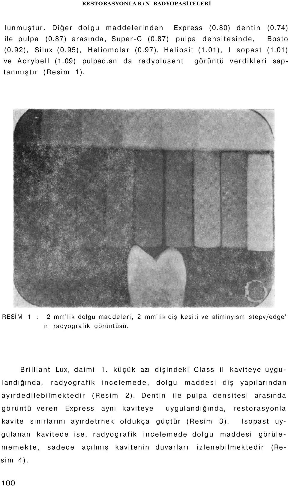 RESİM 1 : 2 mm'lik dolgu maddeleri, 2 mm'lik diş kesiti ve aliminyısm stepv/edge' in radyografik görüntüsü. Brilliant Lux, daimi 1.