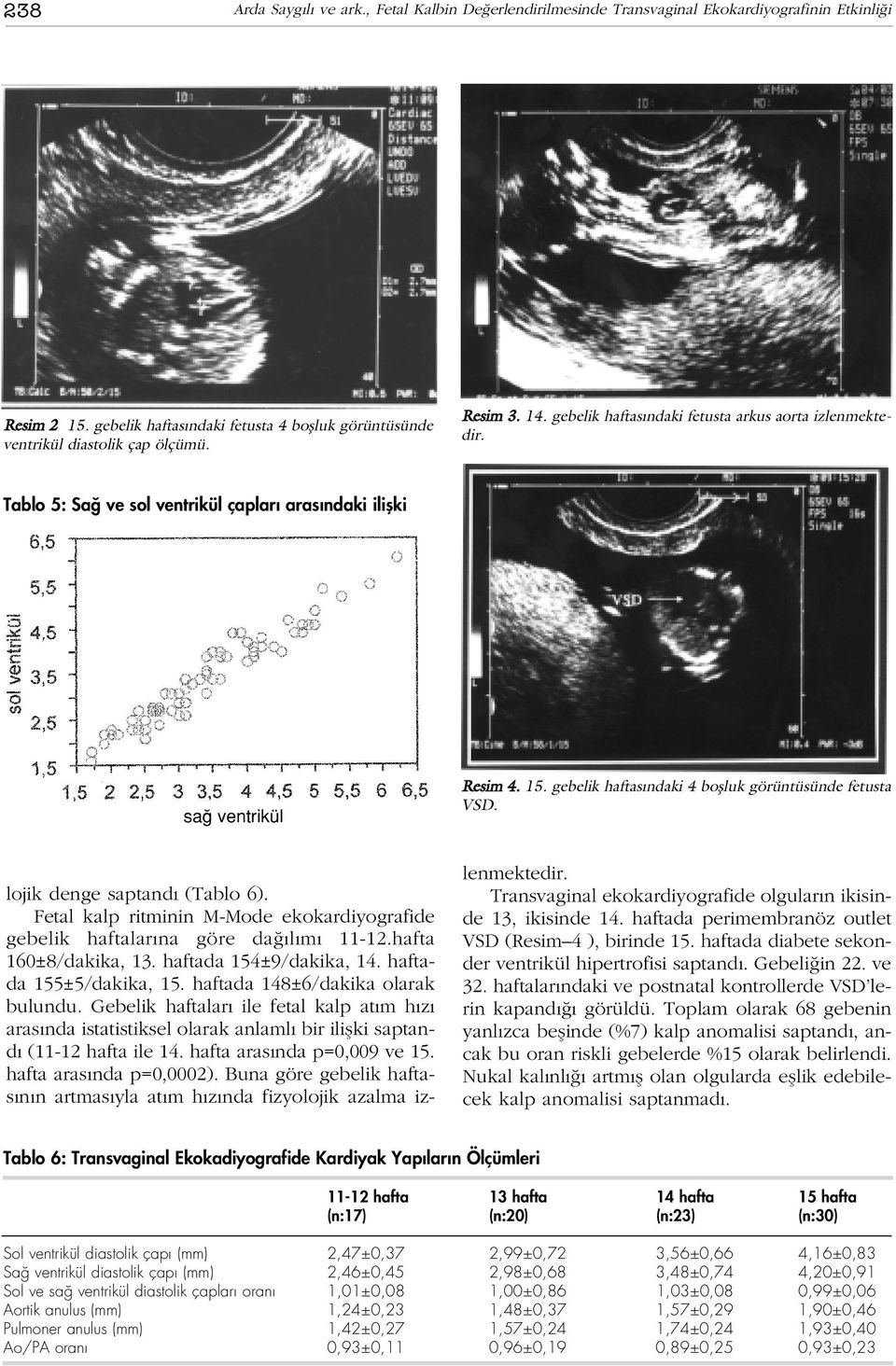 gebelik haftas ndaki 4 boflluk görüntüsünde fetusta VSD. lojik denge saptand (Tablo 6). Fetal kalp ritminin M-Mode ekokardiyografide gebelik haftalar na göre da l m 11-12.hafta 160±8/dakika, 13.
