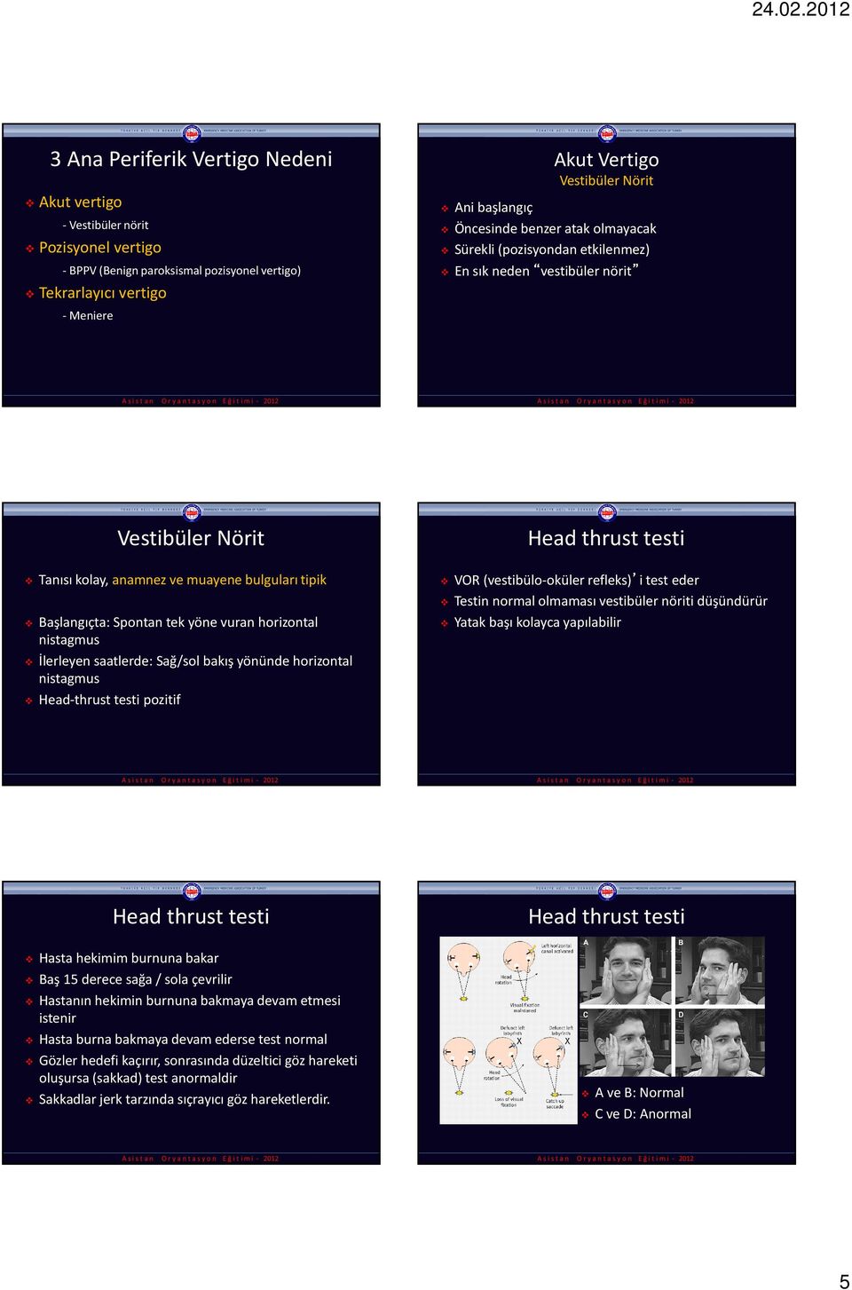 vuran horizontal nistagmus İlerleyen saatlerde: Sağ/sol bakış yönünde horizontal nistagmus Head-thrust testi pozitif Head thrust testi VOR (vestibülo-oküler refleks) i test eder Testin normal