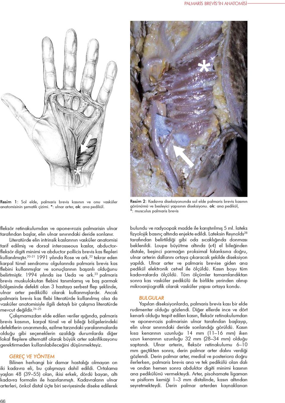 ok: ana pedikül, *: musculus palmaris brevis fleksör retinakulumdan ve aponevrozis palmarisin ulnar tarafından başlar, elin ulnar sınırındaki deride sonlanır.