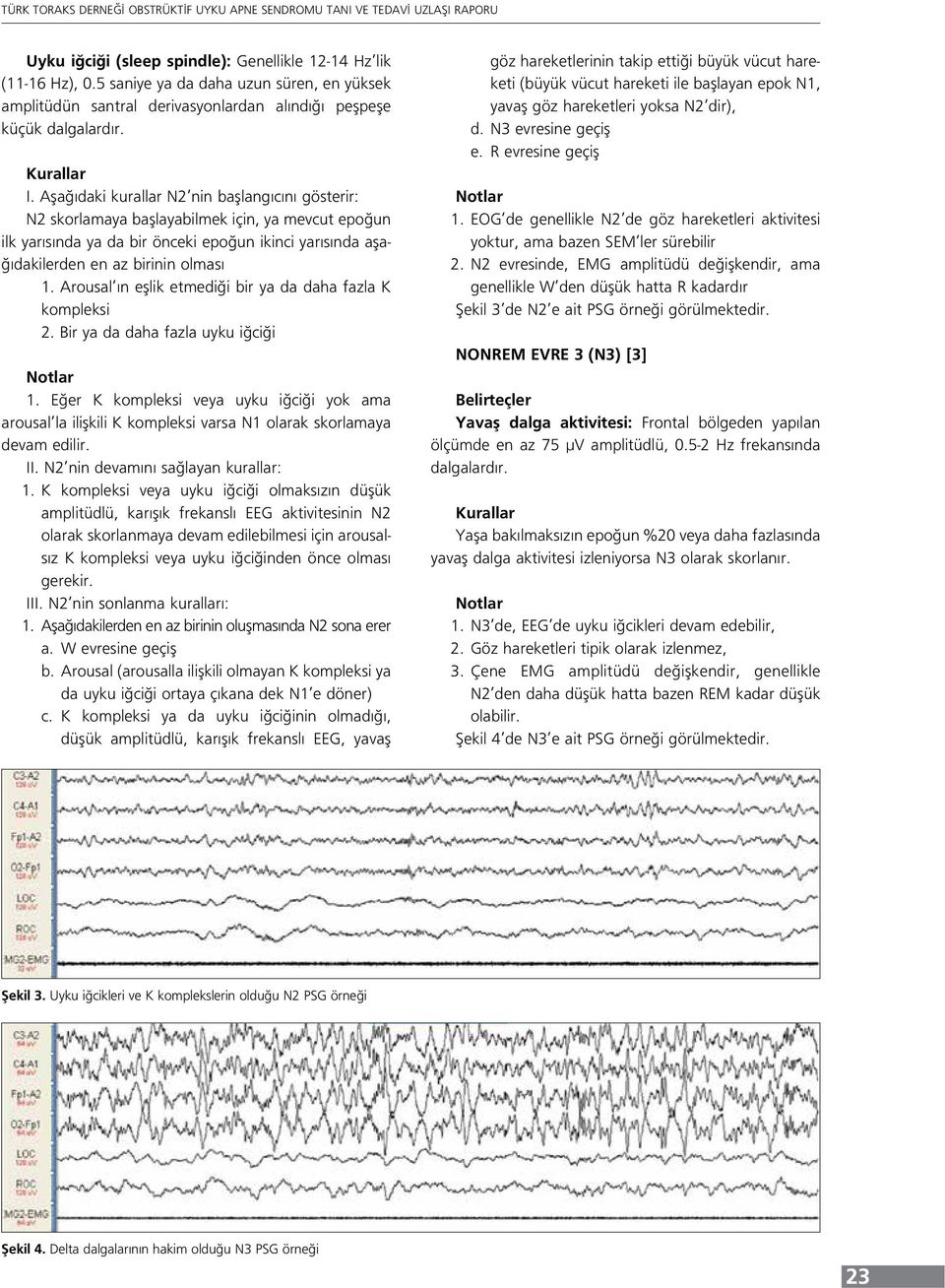 Arousal ın eşlik etmediği bir ya da daha fazla K kompleksi 2. Bir ya da daha fazla uyku iğciği 1.