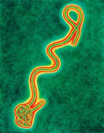 Ebola Virüsü Hastalığı Ebola virüs hastalığı, viral hemorajik ateşlerden biridir. Akut, sistemik, zoonotik bir hastalıktır.