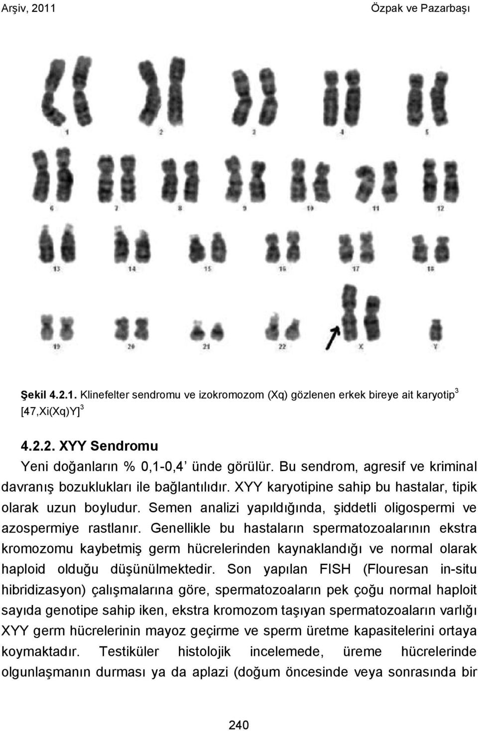 Semen analizi yapıldığında, şiddetli oligospermi ve azospermiye rastlanır.