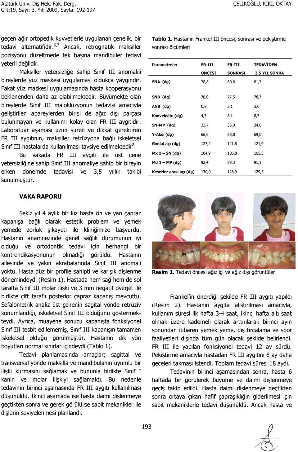 Büyümekte olan bireylerde Sınıf III maloklüzyonun tedavisi amacıyla geliştirilen apareylerden birisi de ağız dışı parçası bulunmayan ve kullanımı kolay olan FR III aygıtıdır.