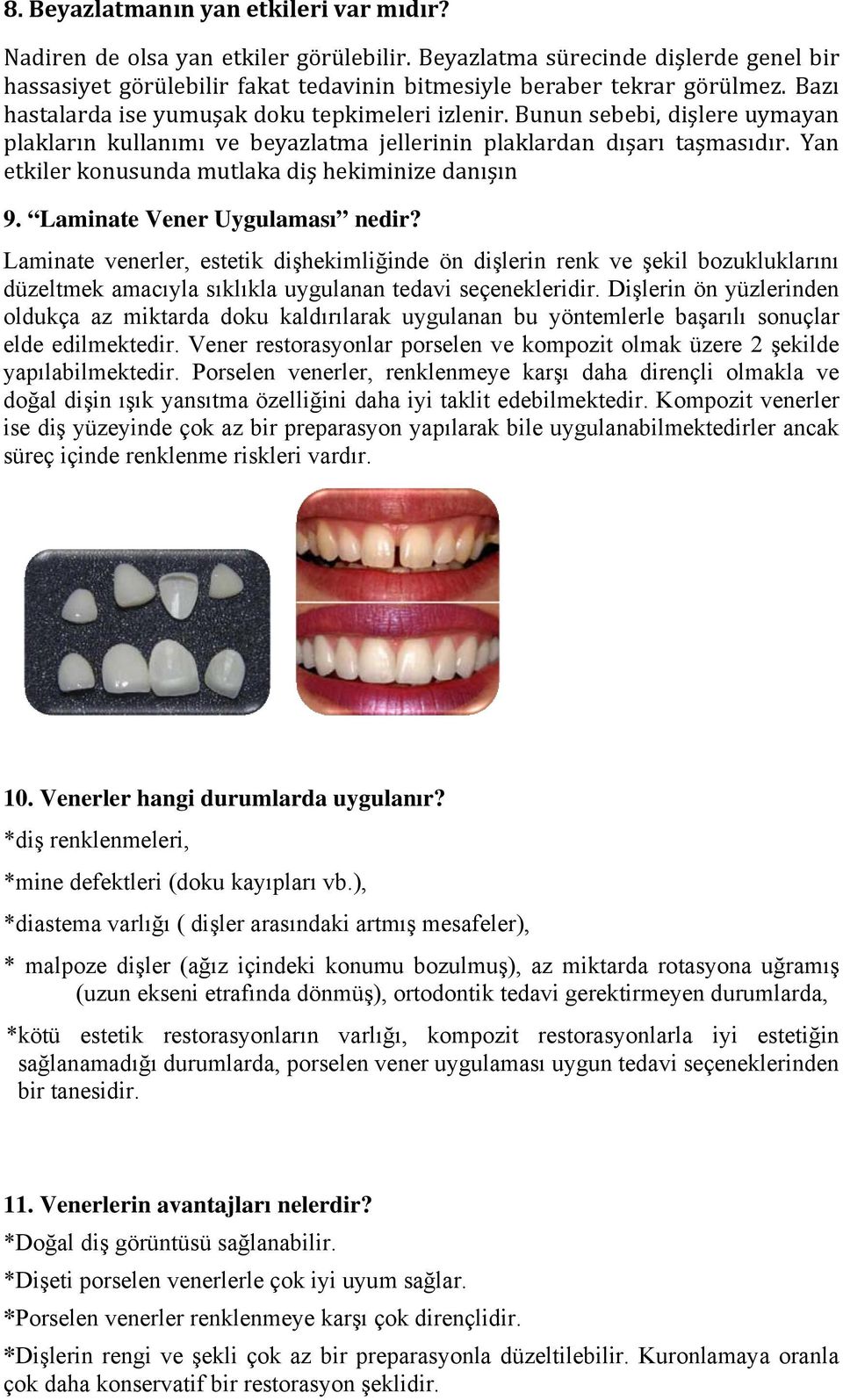 Yan etkiler konusunda mutlaka diş hekiminize danışın 9. Laminate Vener Uygulaması nedir?