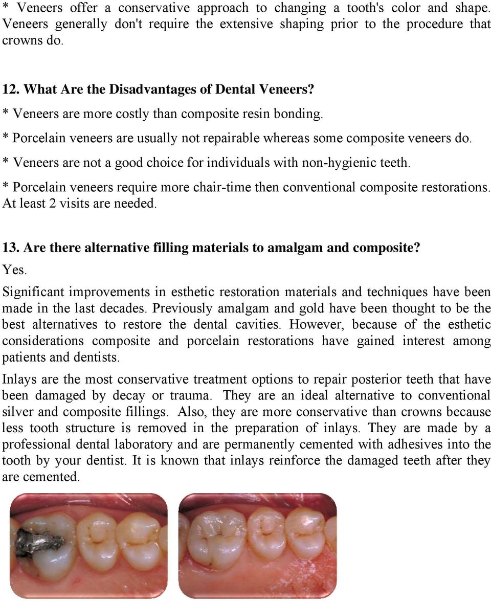 * Veneers are not a good choice for individuals with non-hygienic teeth. * Porcelain veneers require more chair-time then conventional composite restorations. At least 2 visits are needed. 13.