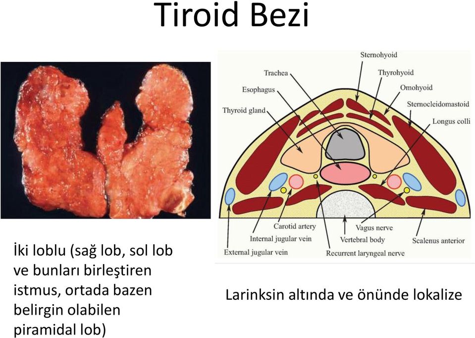 ortada bazen belirgin olabilen