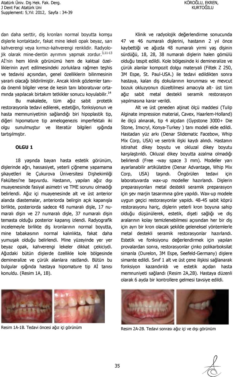 3,11-13 Aİ nin hem klinik görünümü hem de kalıtsal özelliklerinin ayırt edilmesindeki zorluklara rağmen teşhis ve tedavisi açısından, genel özelliklerin bilinmesinin yararlı olacağı bildirilmiştir.