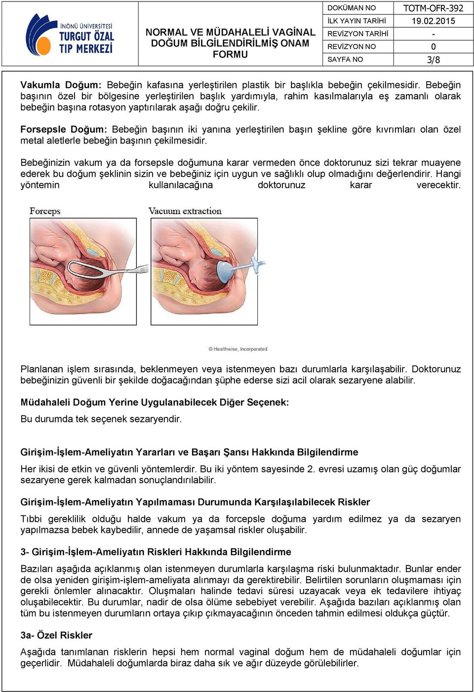 Forsepsle Doğum: Bebeğin başının iki yanına yerleştirilen başın şekline göre kıvrımları olan özel metal aletlerle bebeğin başının çekilmesidir.