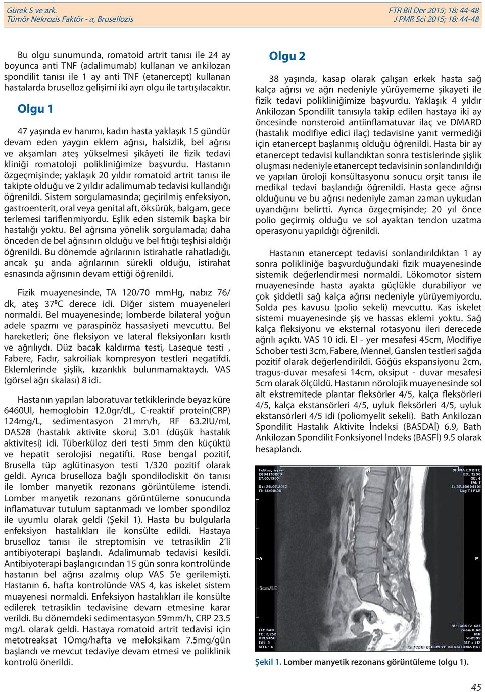 Olgu 1 47 yaşında ev hanımı, kadın hasta yaklaşık 15 gündür devam eden yaygın eklem ağrısı, halsizlik, bel ağrısı ve akşamları ateş yükselmesi şikâyeti ile fizik tedavi kliniği romatoloji