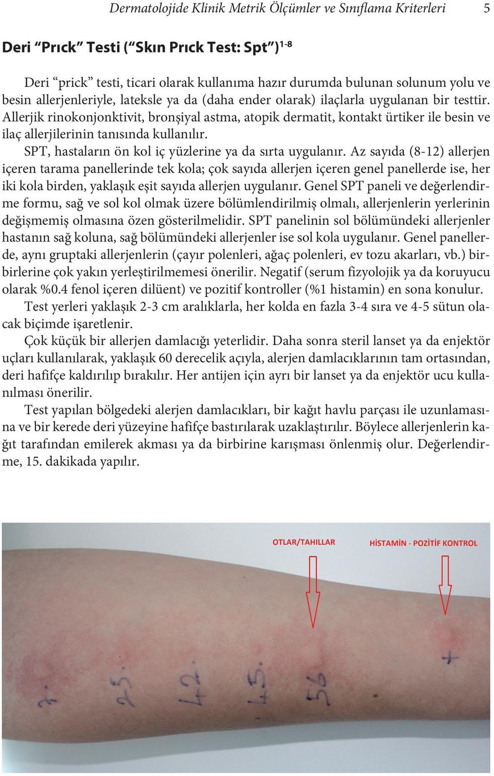 Allerjik rinokonjonktivit, bronşiyal astma, atopik dermatit, kontakt ürtiker ile besin ve ilaç allerjilerinin tanısında kullanılır. SPT, hastaların ön kol iç yüzlerine ya da sırta uygulanır.