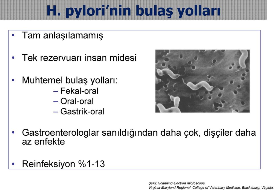 daha çok, dişçiler daha az enfekte Reinfeksiyon %1-13 Şekil: Scanning electron