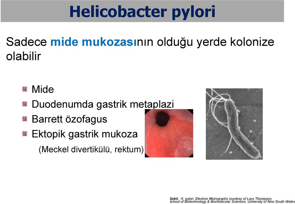 divertikülü, rektum) Şekil. H. pylori.