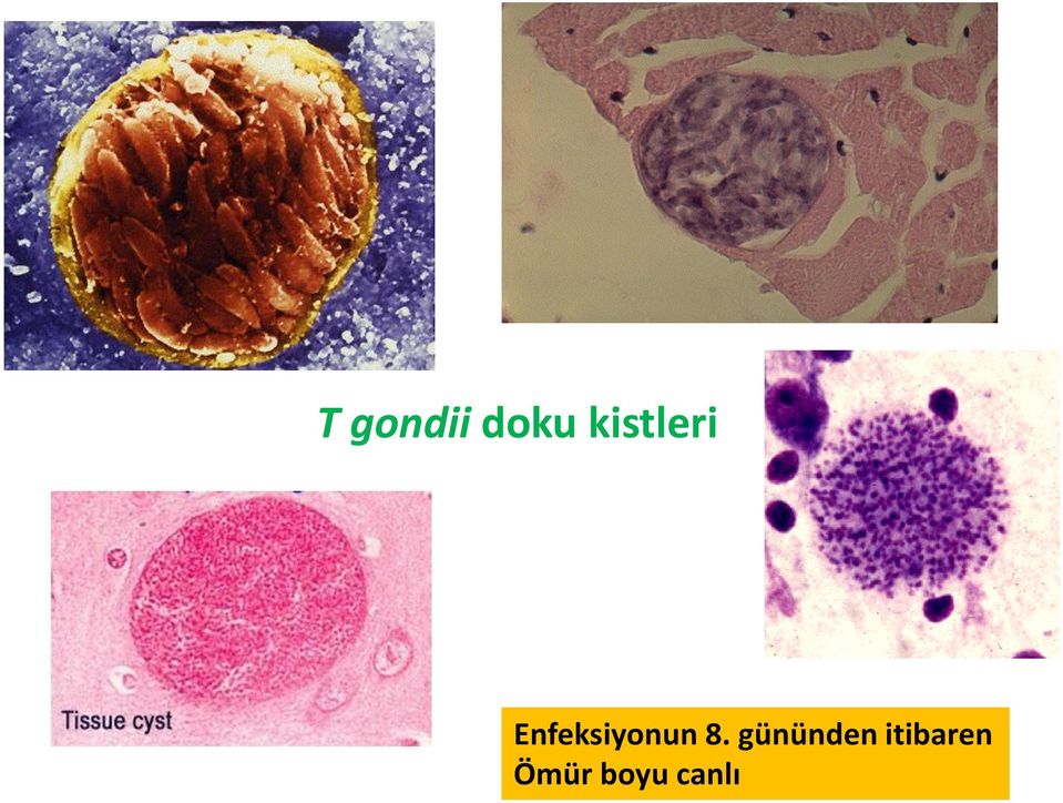 Enfeksiyonun 8.