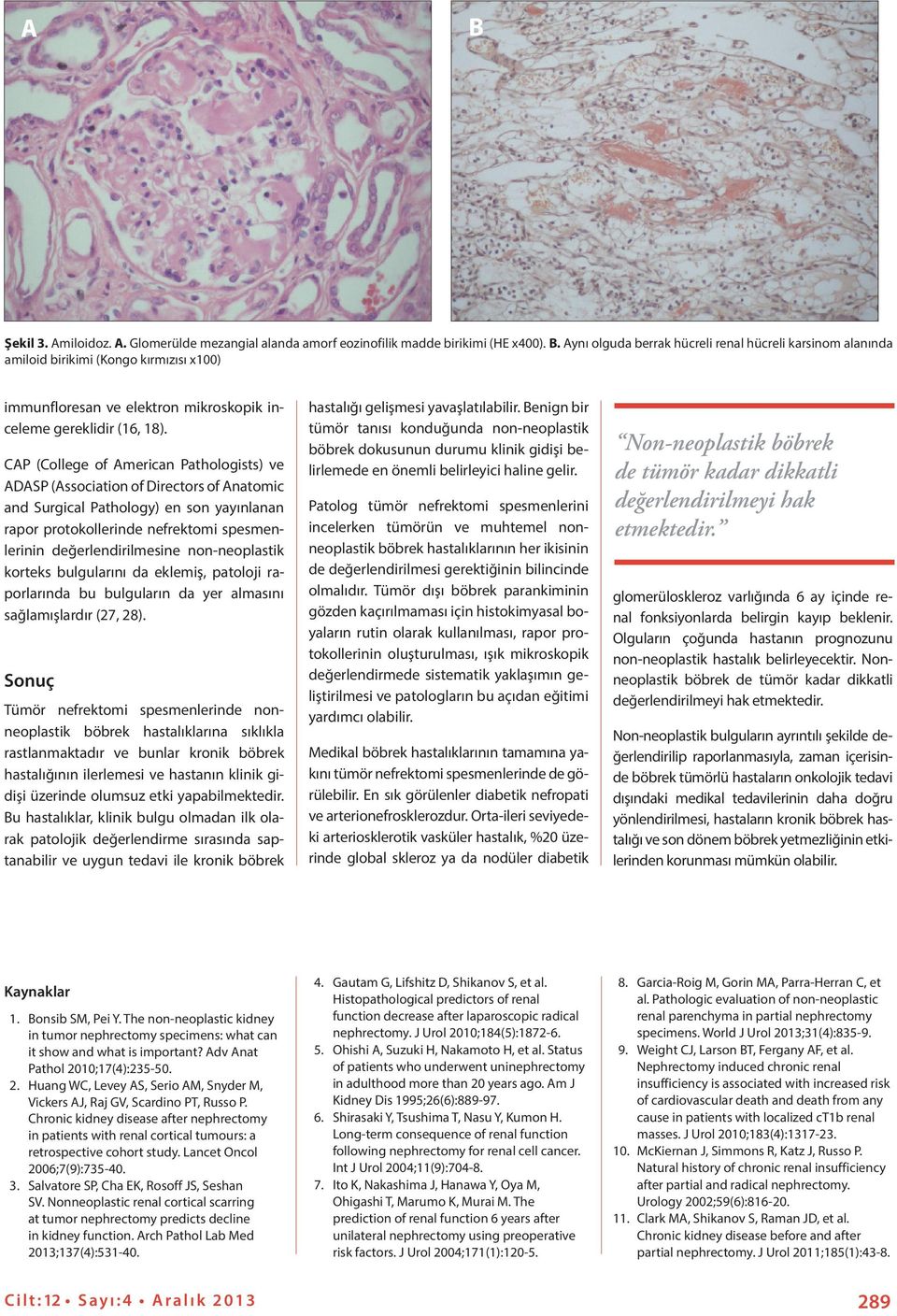 non-neoplastik korteks bulgularını da eklemiş, patoloji raporlarında bu bulguların da yer almasını sağlamışlardır (27, 28).