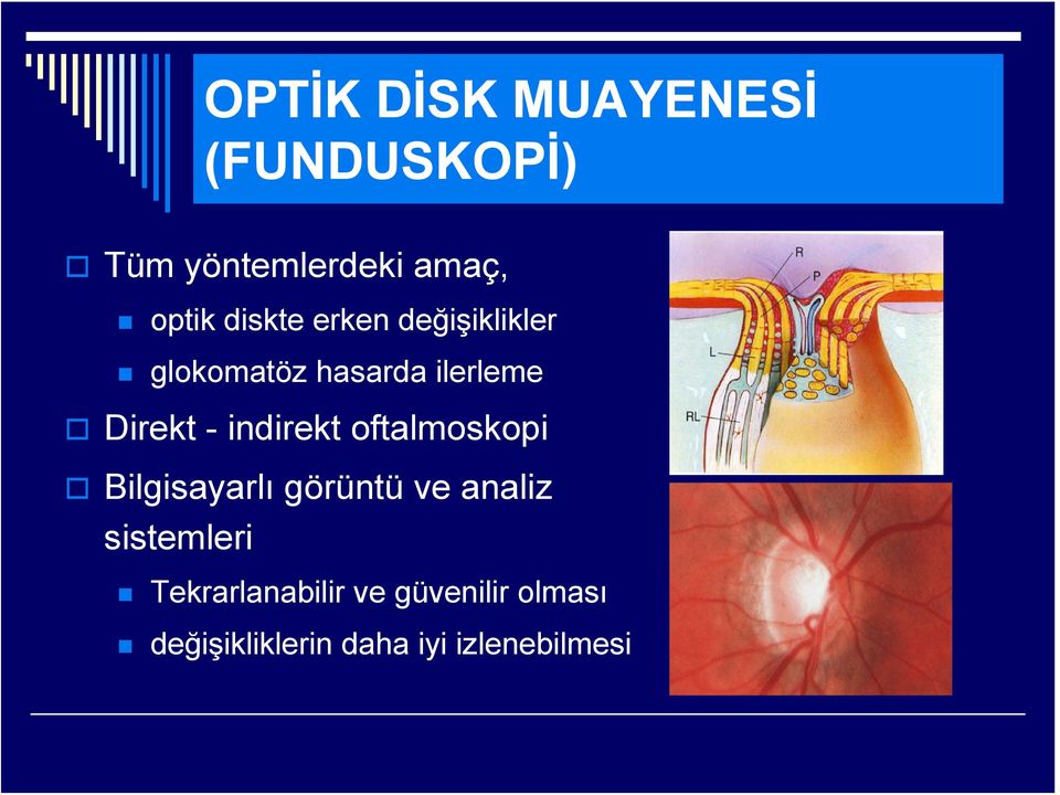 indirekt oftalmoskopi Bilgisayarlı görüntü ve analiz sistemleri