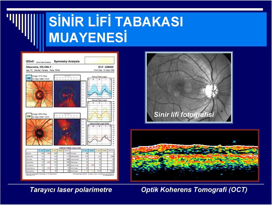 fotoğrafisi Tarayıcı laser