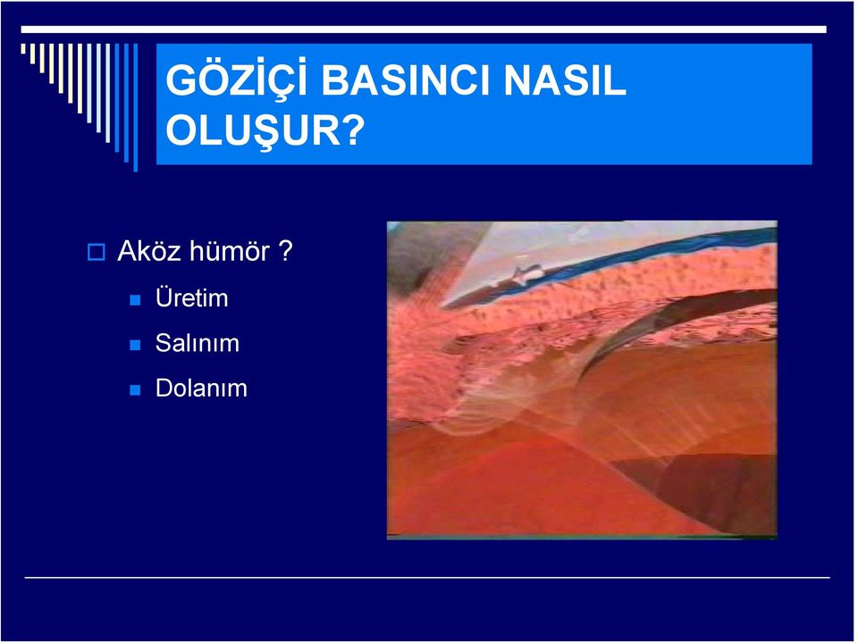 Aköz hümör?