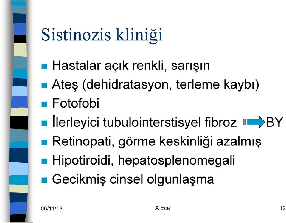 tubulointerstisyel fibroz Retinopati, görme keskinliği