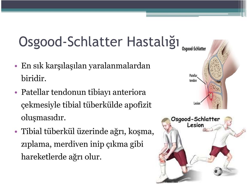 Patellar tendonun tibiayı anteriora çekmesiyle tibial