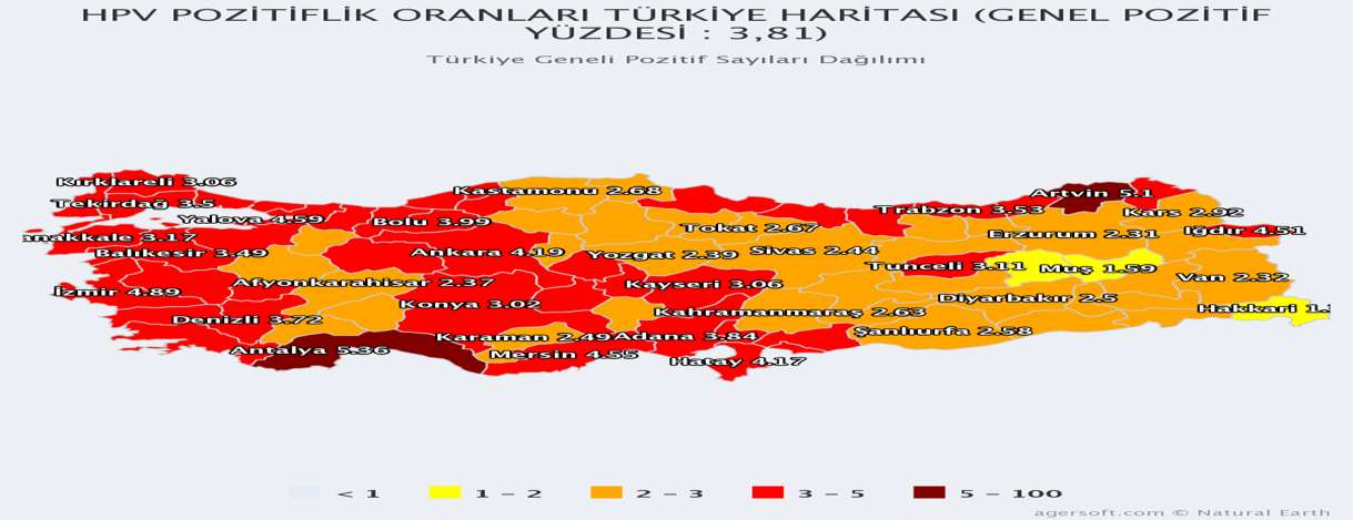 Türkiye