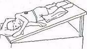Sol Alt Lob Yan Segment: Birey trendelenburg pozisyonunda sağ yanına yatırılır. Yatağın ayak kısmı 45-50 derece yükseltilir.