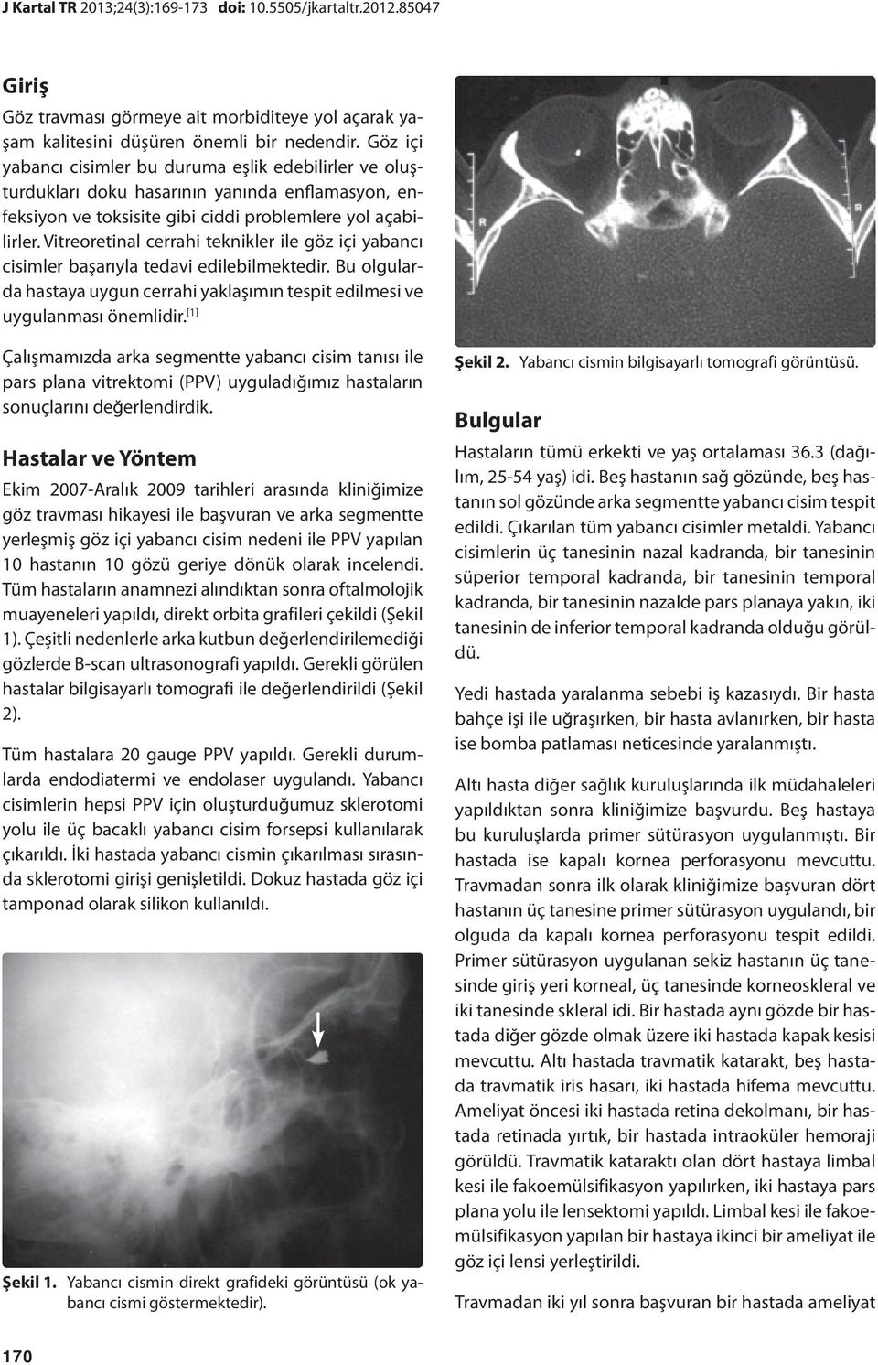 Vitreoretinal cerrahi teknikler ile göz içi yabancı cisimler başarıyla tedavi edilebilmektedir. Bu olgularda hastaya uygun cerrahi yaklaşımın tespit edilmesi ve uygulanması önemlidir.