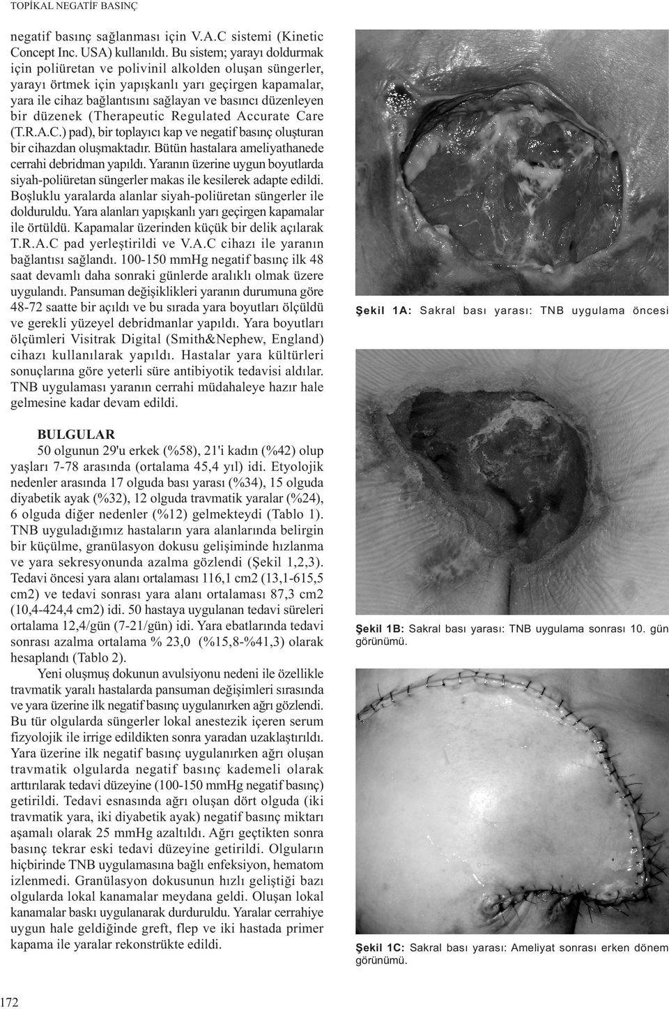 bir düzenek (Therapeutic Regulated Accurate Care (T.R.A.C.) pad), bir toplayýcý kap ve negatif basýnç oluþturan bir cihazdan oluþmaktadýr. Bütün hastalara ameliyathanede cerrahi debridman yapýldý.