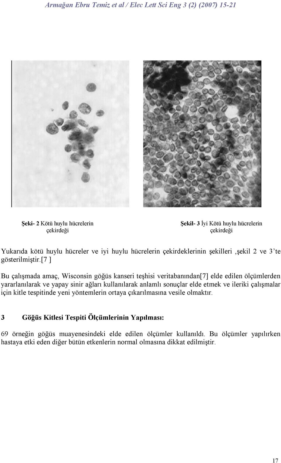 [7 ] Bu çalışmada amaç, Wisconsin göğüs kanseri teşhisi veritabanından[7] elde edilen ölçümlerden yararlanılarak ve yapay sinir ağları kullanılarak anlamlı sonuçlar