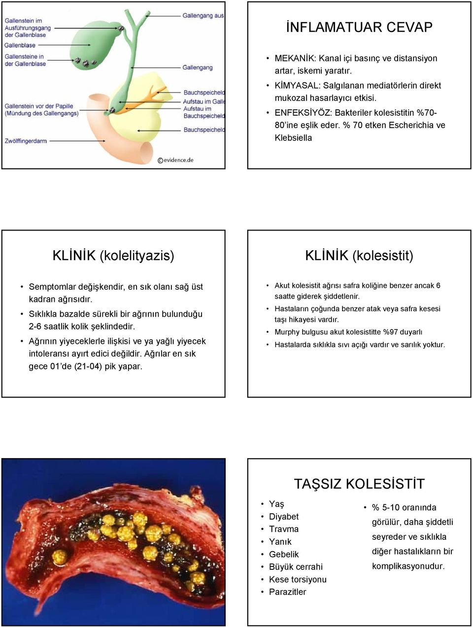 Sıklıkla bazalde sürekli bir ağrının bulunduğu 2-6 saatlik kolik şeklindedir. Ağrının yiyeceklerle ilişkisi ve ya yağlı yiyecek intoleransı ayırt edici değildir.