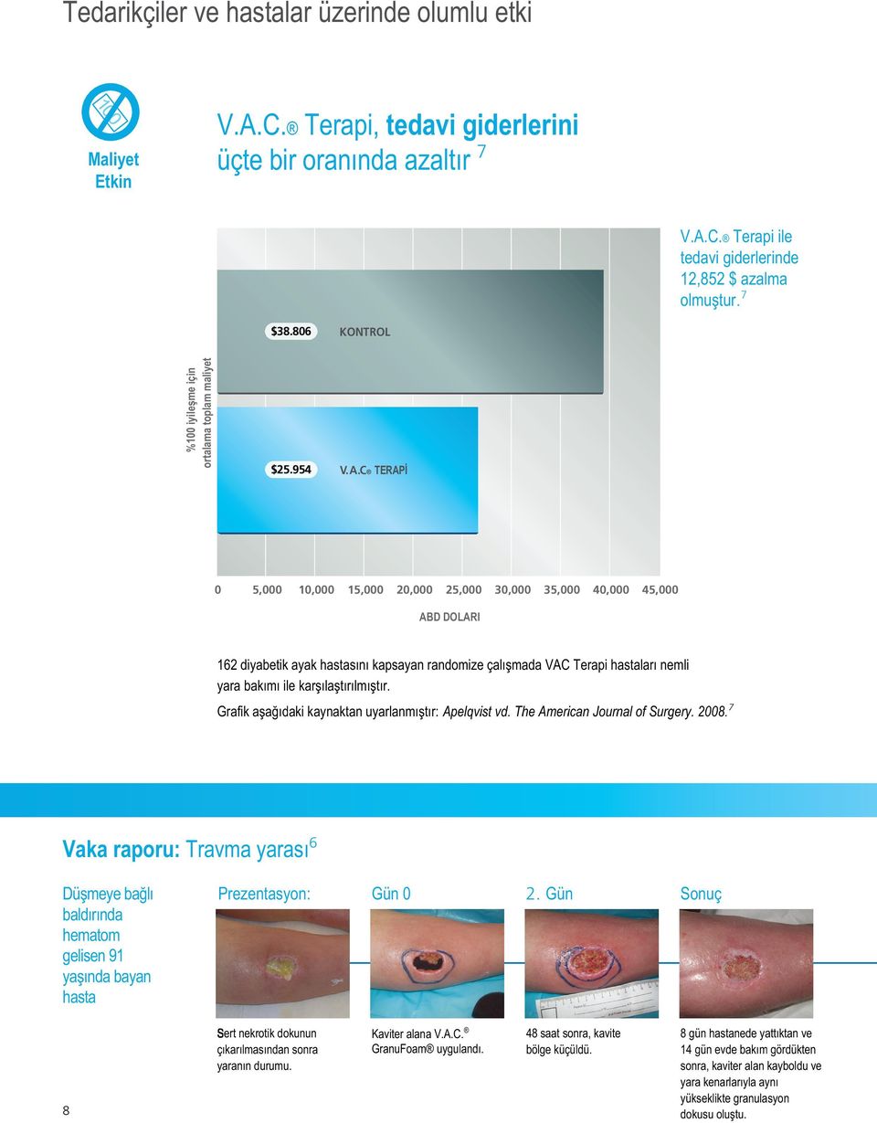 C TERAPİ 0 5,000 10,000 15,000 20,000 25,000 30,000 35,000 40,000 45,000 ABD DOLARI 162 diyabetik ayak hastasını kapsayan randomize çalışmada VAC Terapi hastaları nemli yara bakımı ile