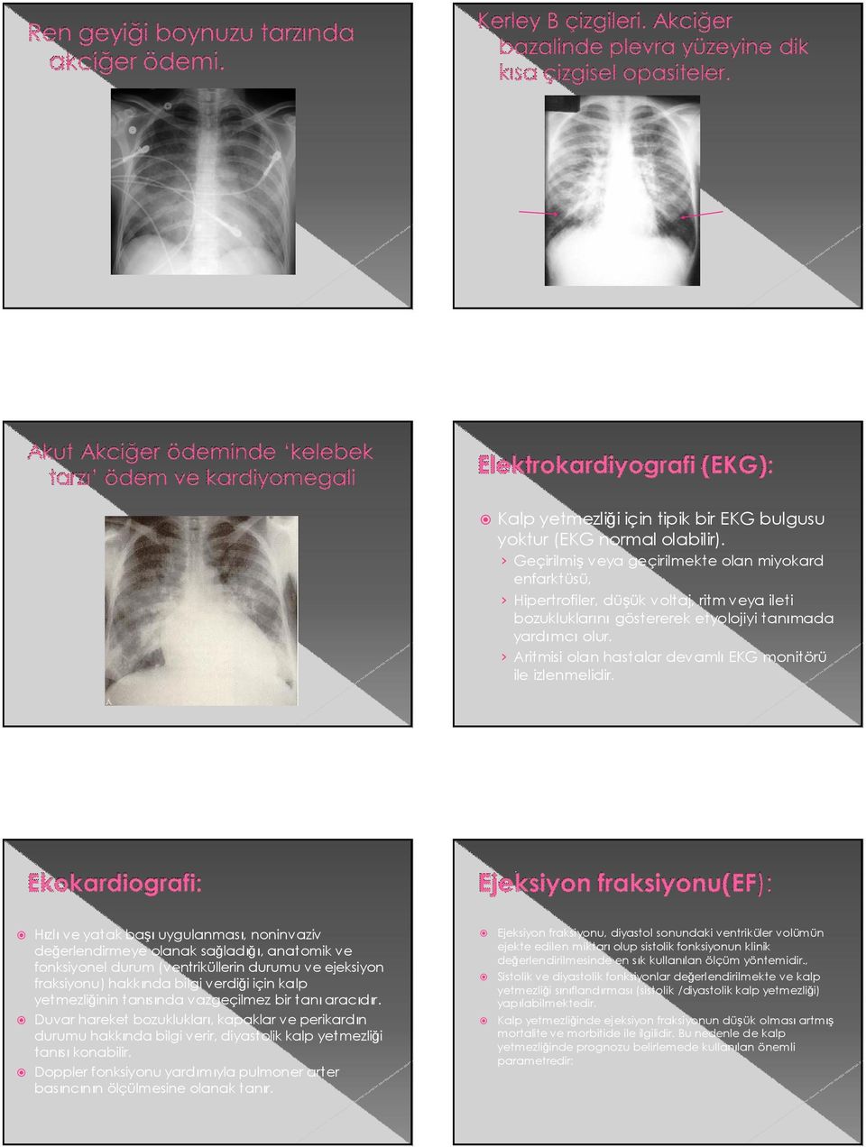 Aritmisi olan hastalar devamlı EKG monitörü ile izlenmelidir.