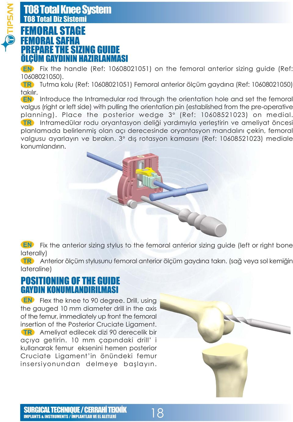 Introduce the Intramedular rod through the orientation hole and set the femoral valgus (right or left side) with pulling the orientation pin (established from the pre-operative planning).