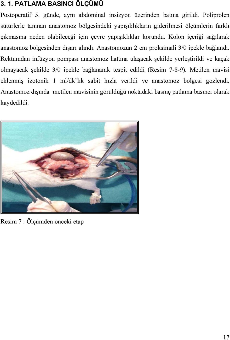 Kolon içeriği sağılarak anastomoz bölgesinden dışarı alındı. Anastomozun 2 cm proksimali 3/0 ipekle bağlandı.