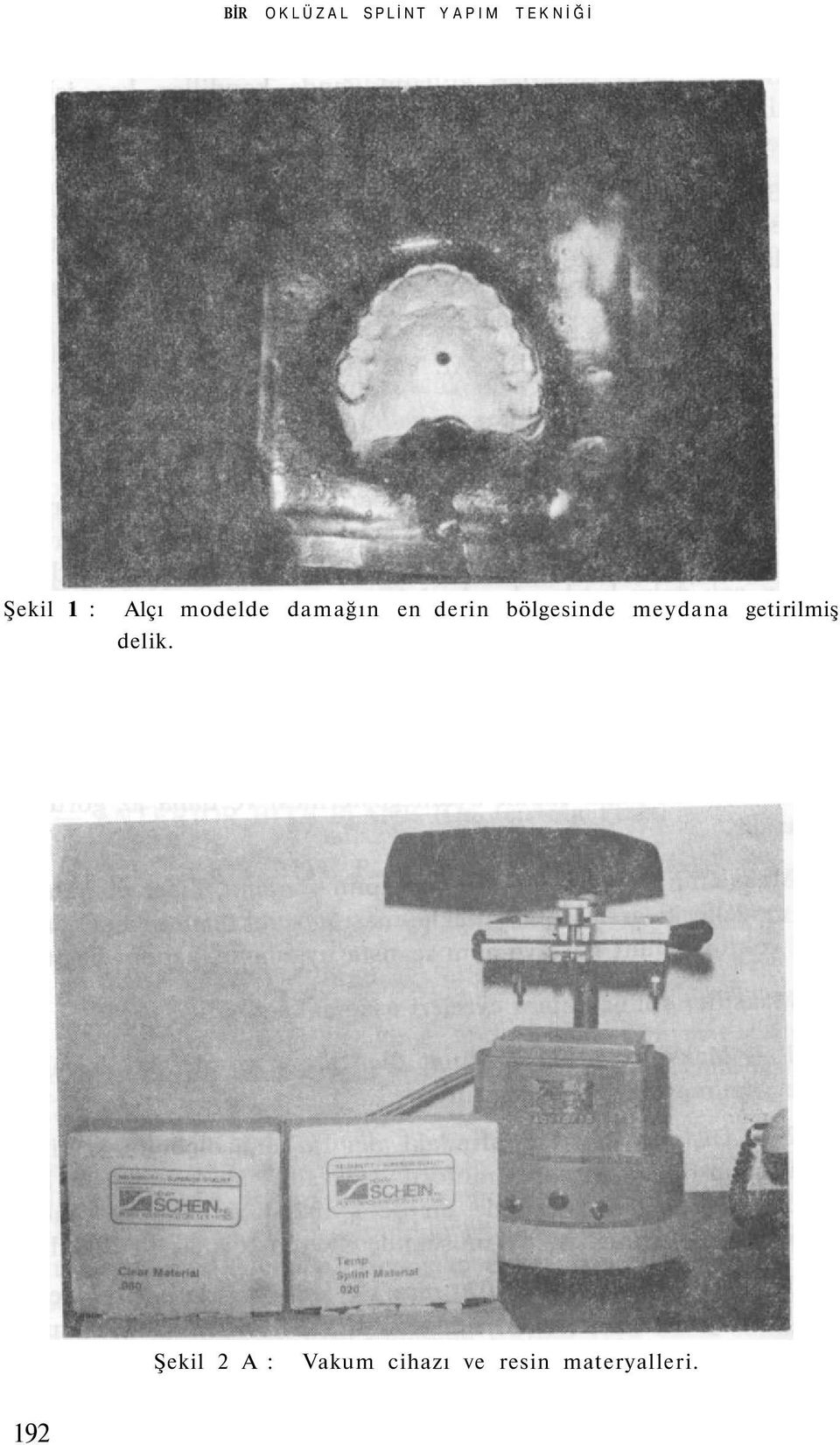 bölgesinde meydana getirilmiş delik.