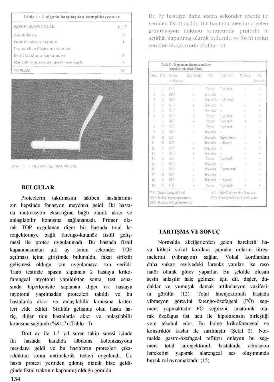 Bu hastada fistül kapanmasından altı ay sonra sekonder TÖF açılması içinn girişimde bulunuldu, fakat striktür gelişmesi olduğu için uygulamaya son verildi.