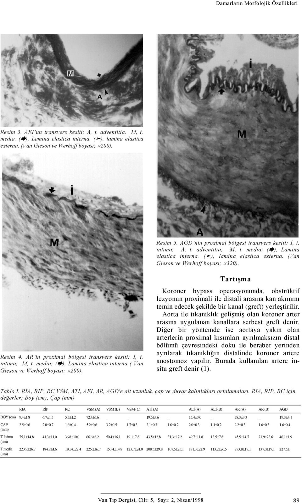 Resim 4. AR in proximal bölgesi transvers kesiti: İ, t. intima; M, t. media; ( ), Lamina elastica interna ( Van Gieson ve Werhoff boyası; 200).