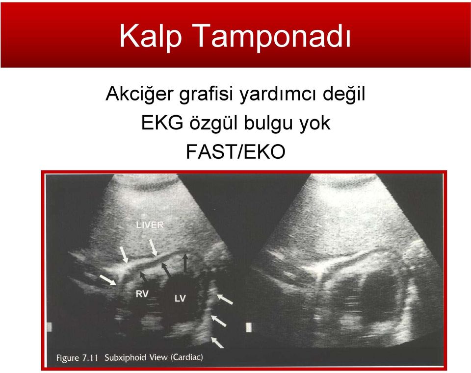 yardımcı değil EKG