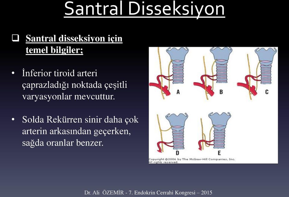 varyasyonlar mevcuttur.