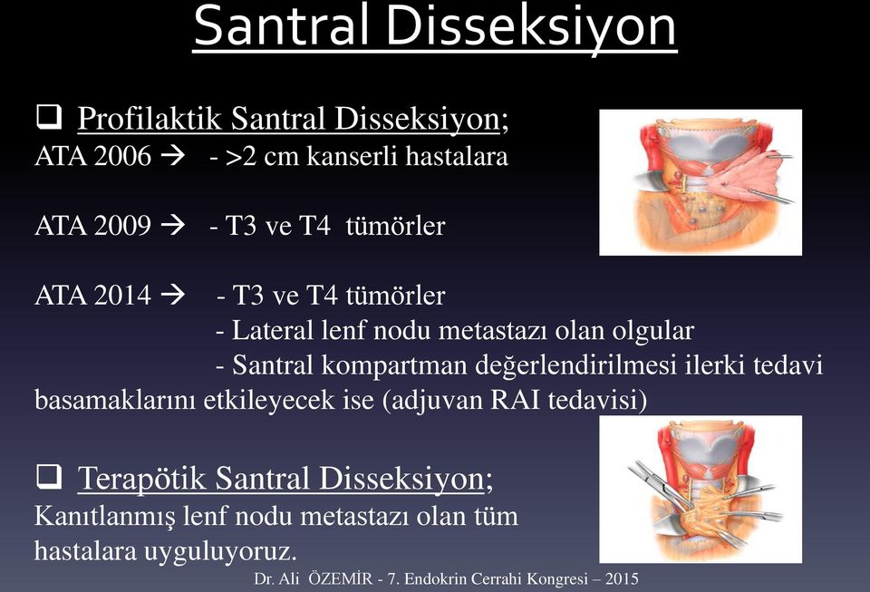 - T3 ve T4 tümörler ATA 2014 - T3 ve T4 tümörler - Lateral lenf nodu metastazı olan olgular -