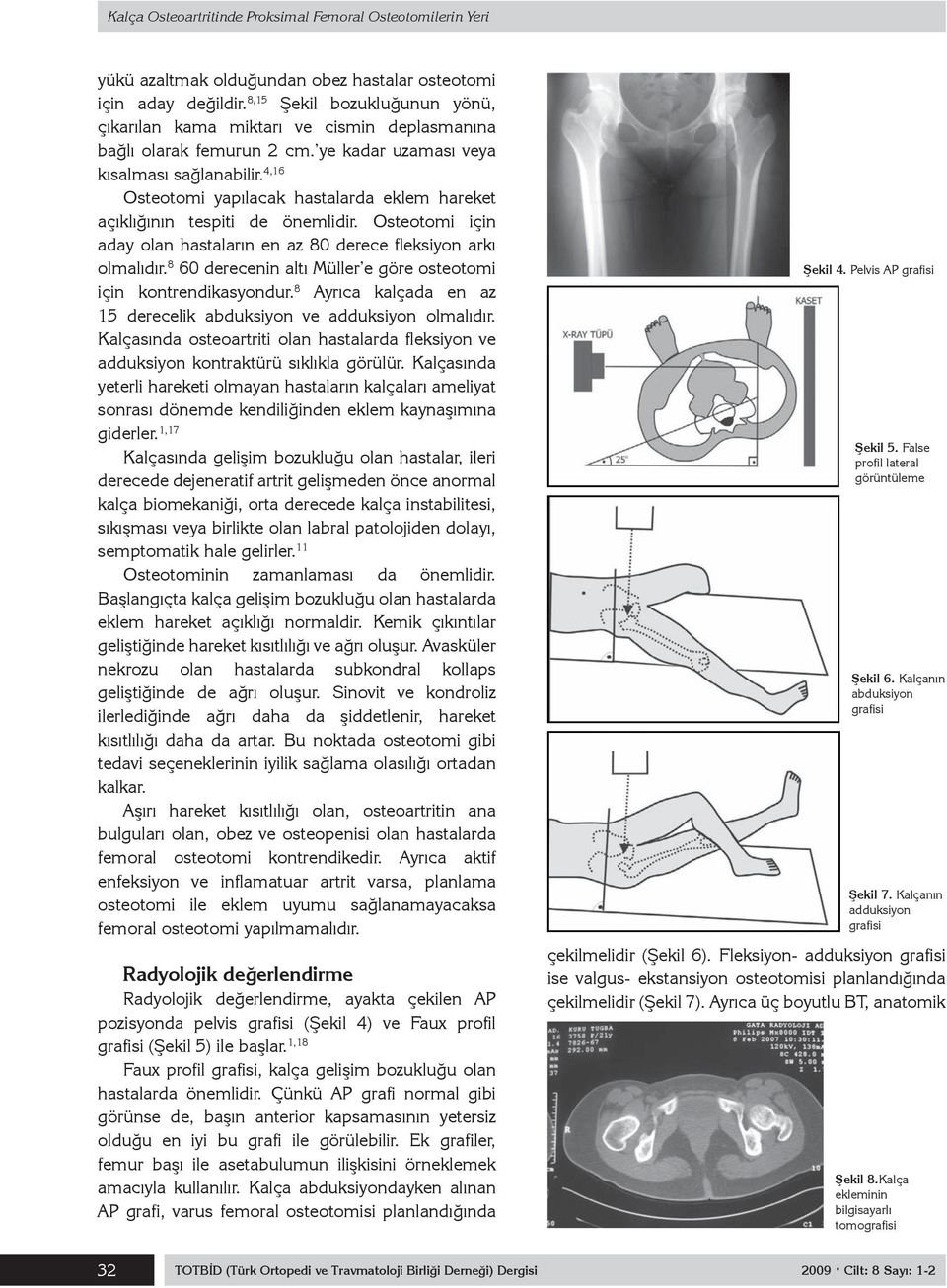 4,16 Osteotomi yapılacak hastalarda eklem hareket açıklığının tespiti de önemlidir. Osteotomi için aday olan hastaların en az 80 derece fleksiyon arkı olmalıdır.