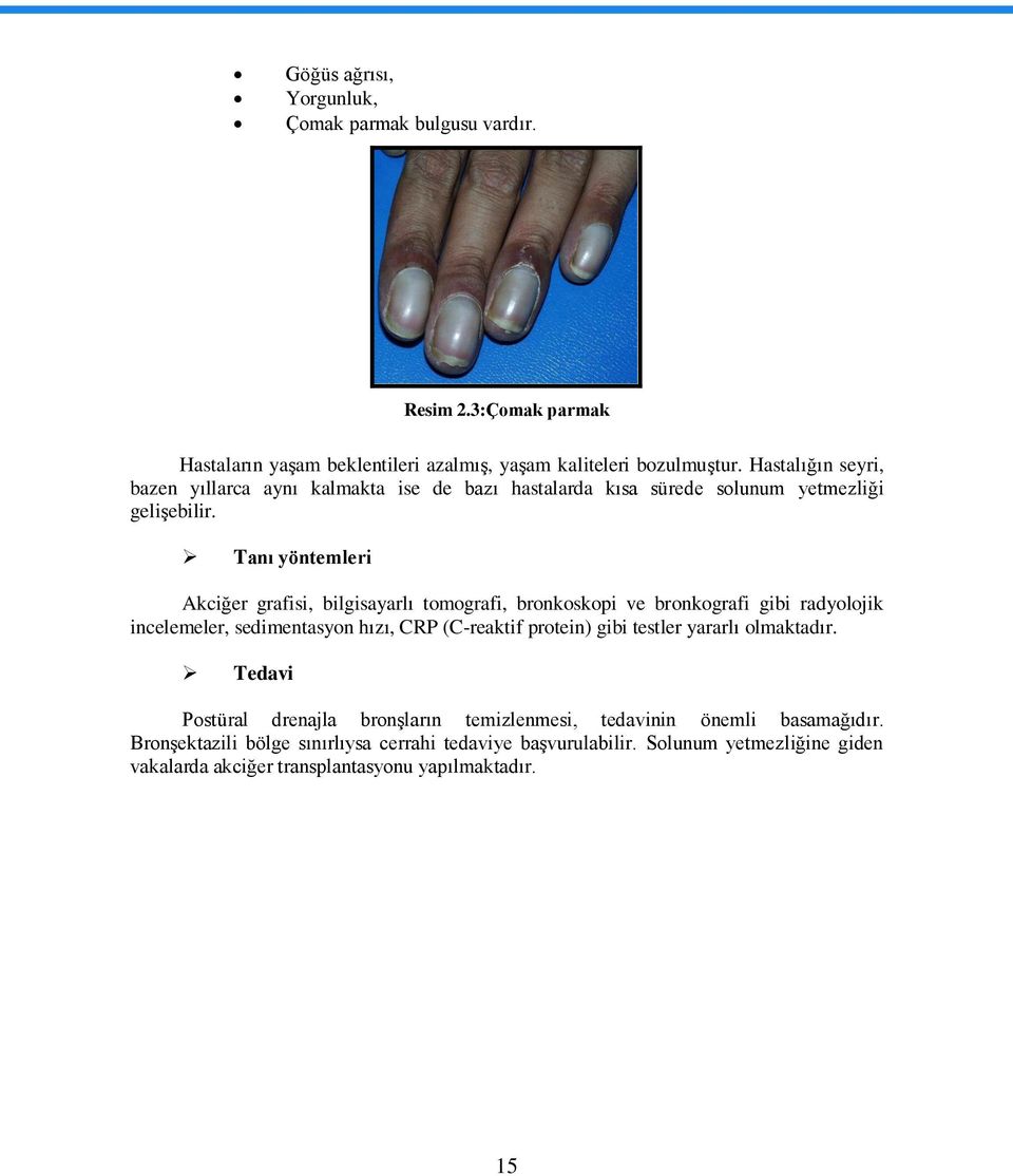 Tanı yöntemleri Akciğer grafisi, bilgisayarlı tomografi, bronkoskopi ve bronkografi gibi radyolojik incelemeler, sedimentasyon hızı, CRP (C-reaktif protein) gibi