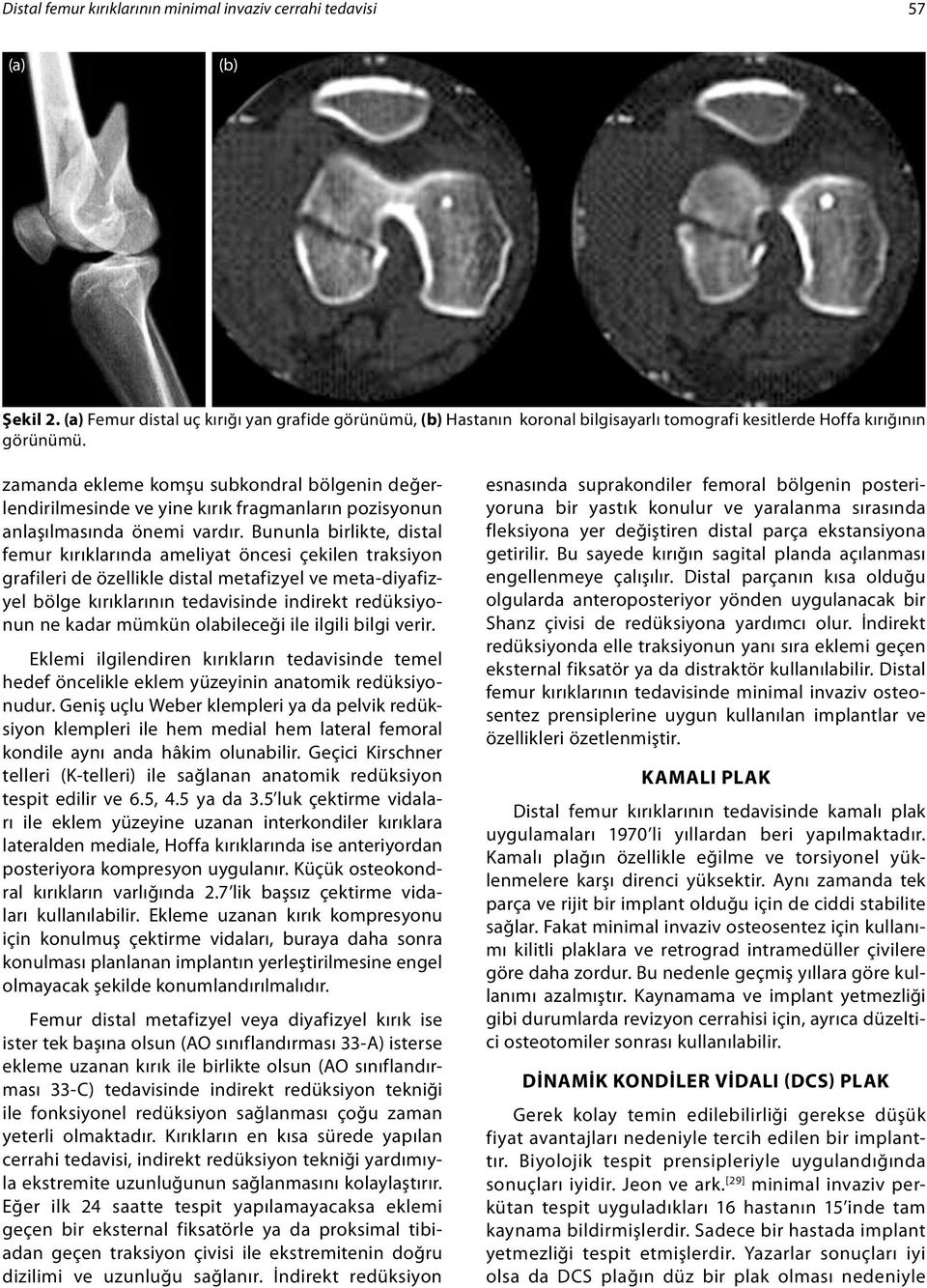 zamanda ekleme komşu subkondral bölgenin değerlendirilmesinde ve yine kırık fragmanların pozisyonun anlaşılmasında önemi vardır.