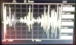 semg Sinyali Algılama Devresi Çıkış Sinyali Osilaskop ekranında izlenen semg sinyali, kullanılacak kablosuz erişim teknolojisine göre çeşitli